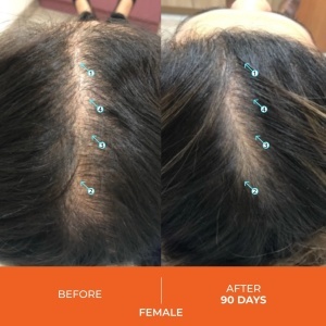 Revita gummies for hair growth support 60g - Img 3