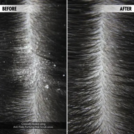 Exfoliant purificator anti-mătreaţă pentru scalp DUOLOGI - Img 4