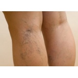 Leg Vein Essentials 60 vcaps DRcaps Swanson SWC093 - Img 2