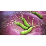 Tratament Naturist Eficient Helicobacter Pylori 2 Luni Mastic Gum Colostrum Sulforaphane - Img 3