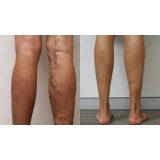 Leg Vein Essentials 60 vcaps DRcaps Swanson SWC093 - Img 3
