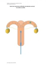 tehnici de inseminare