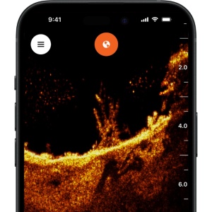Navomodel Deeper QUEST pentru Nadit cu Sonar CHIRP si DownScan Undervision - Img 11