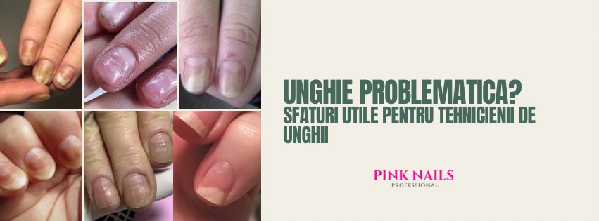 Unghie problematica? Sfaturi utile pentru tehnicienii de unghii!