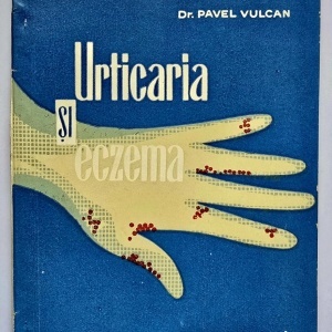 Dr. Pavel Vulcan - Urticaria si eczema