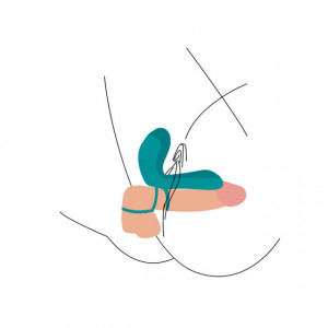 Vibro prsten sa daljinskim | XOCOON Couples Vibrator Ring