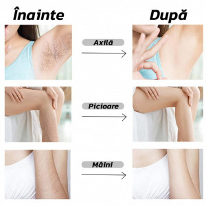 Epilator cu Cristale - epilare fara durere