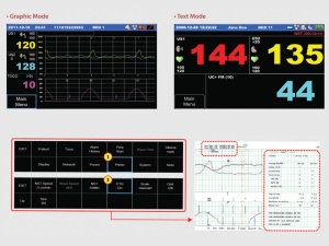 Monitor fetal unic - Img 3