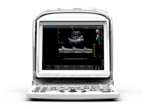 Unitate portabilă cu ultrasunete cu 2 conectori - Img 2