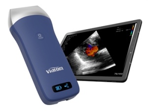 Scanner de mana pentru ecograf - Img 2