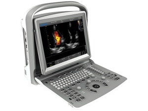 Unitate ecografie cu ultrasunete
