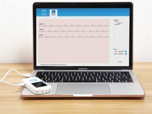 Electrocardiograf cu 1-3 canale - Img 3
