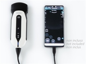 Sistem de ecografie Palm - Img 2
