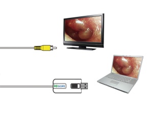 Otoscop video cu 2 sonde - Img 4