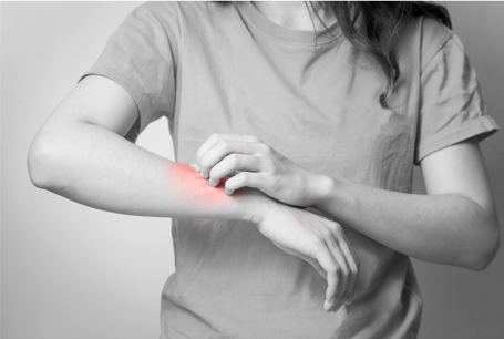 Combaterea dermatitei cu ajutorul uleiurilor vegetale, unturilor și uleiurilor esențiale Plant Therapy
