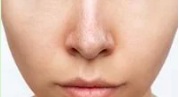 RUTINĂ SIMPLĂ  PENTRU ELIMINAREA PUNCTELOR NEGRE CU ULEIURI ESENTIALE PLANT THERAPY