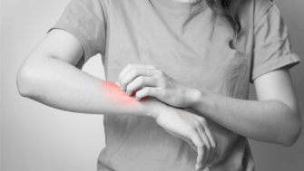 Combaterea dermatitei cu ajutorul uleiurilor vegetale, unturilor și uleiurilor esențiale Plant Therapy