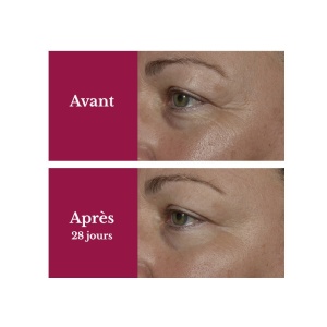 Cremă contur ochi și buze LILY ACTIVE, 15ml - Img 3