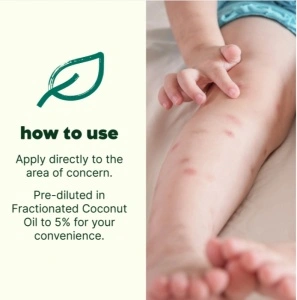Itch Away KidSafe Prediluat Roll-on - Img 4