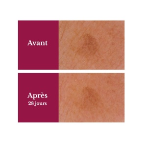 Ser concentrat intensiv pentru corectarea petelor pigmentare LILY ACTIVE, 15ml - Img 3