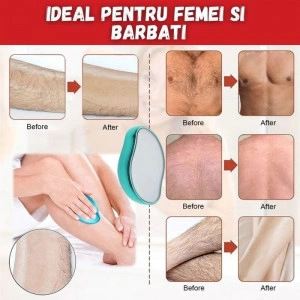 Epilator - Img 3