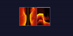SONDA SONAR GARMIN ULTRA HIGH-DEFINITION SCANNING SONAR SYSTEM