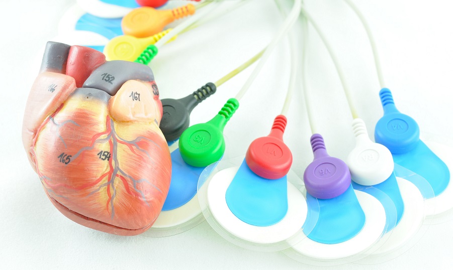 Electrozi și Cabluri EKG: Echipamente Esențiale pentru Monitorizarea Cardiovasculară