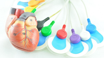 Electrozi și Cabluri EKG: Echipamente Esențiale pentru Monitorizarea Cardiovasculară