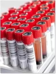 Vacutainer biochimie, dop rosu, Clot activator, 6 ml