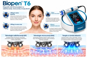 Bio Pen T6 cu radiofrecventa RF, microcurenti EMS, lumina albastra si masaj rotativ 360° - Img 4