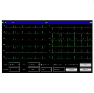 Electrocardiograf Contec ECG 600G - Img 4