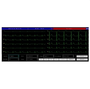 Electrocardiograf Contec ECG 600G - Img 6