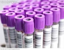 Vacutainer hematologie 2 ml