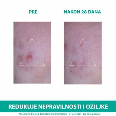 URIAGE HYSEAC 3-regular PLUS KREMA 40ml - Img 4