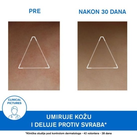 URIAGE XEMOSE C8+ CERAT 200ml - Img 4