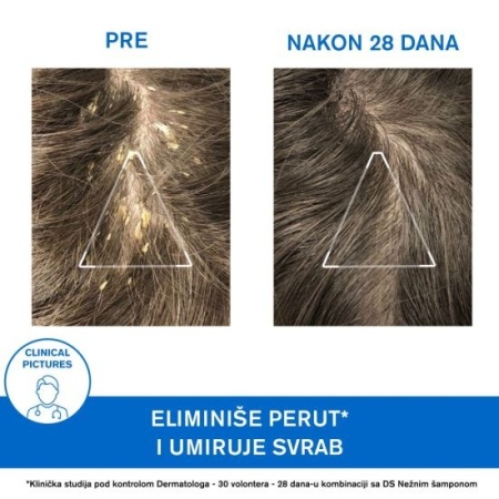 URIAGE DS keratoregulujući šampon 150ml - Img 4