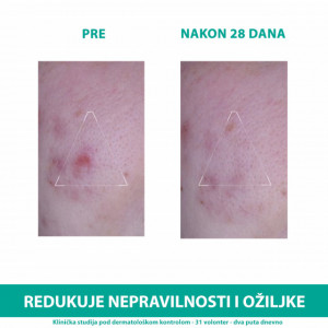 URIAGE HYSEAC 3-regular PLUS KREMA 40ml - Img 4