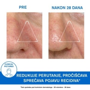 URIAGE D.S. emulzija 40ml - Img 4