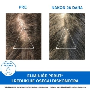 URIAGE DS šampon protiv peruti 200ml - Img 4