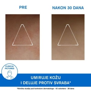 URIAGE XEMOSE C8+ CERAT 200ml - Img 4