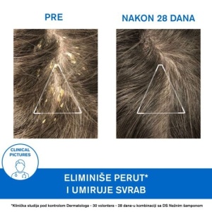 URIAGE DS keratoregulujući šampon 150ml - Img 4