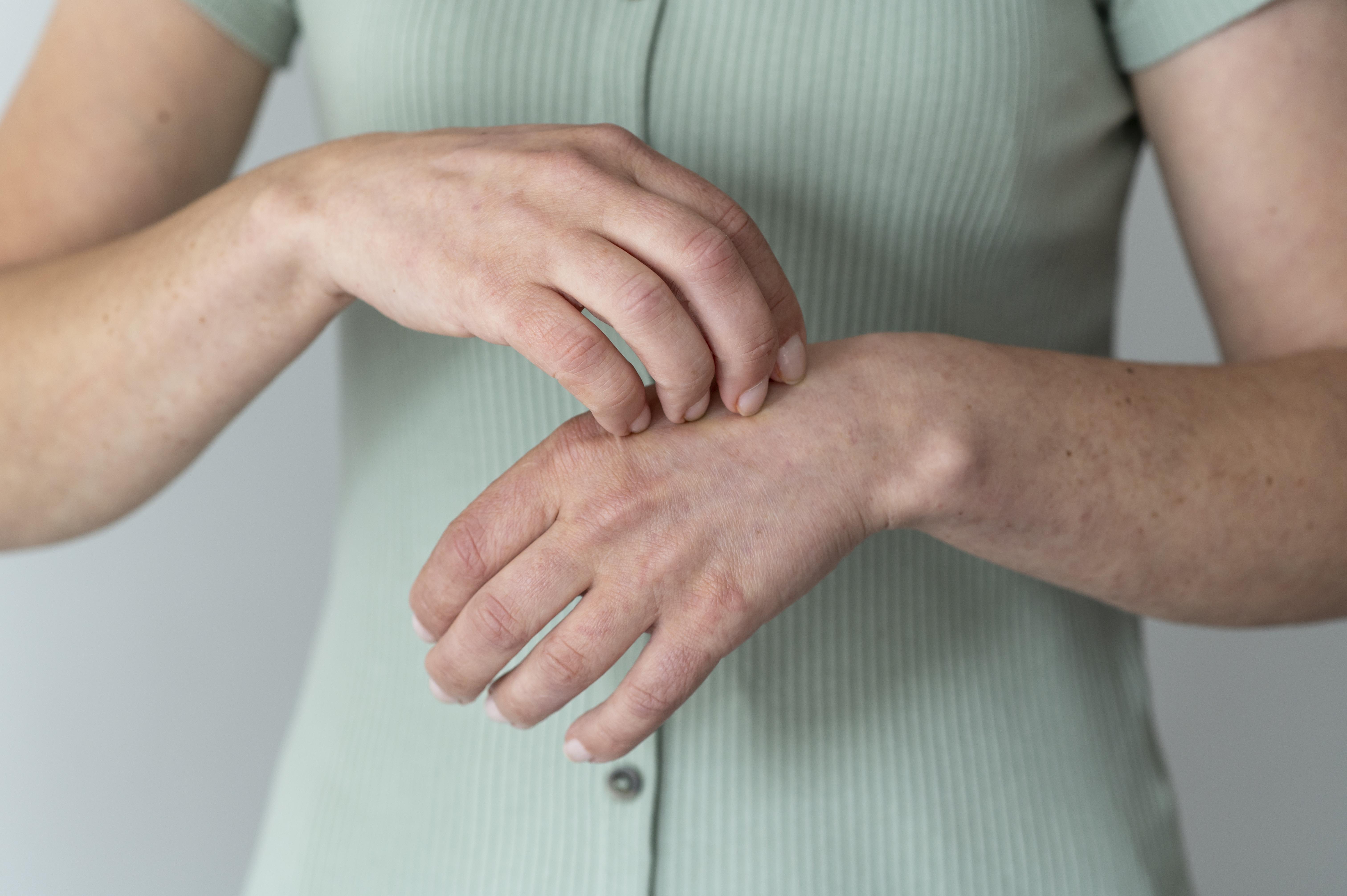 Dermatita atopică: cauze, simptome, diagnostic și opțiuni de tratament