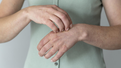 Dermatita atopică: cauze, simptome, diagnostic și opțiuni de tratament