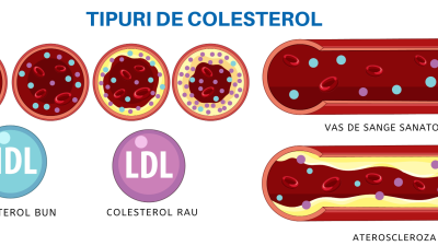 Raportul dintre colesterolul LDL și HDL: ce înseamnă și cum se calculează