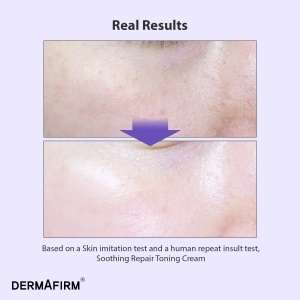Crema tonifianta cu Glutathione Nano Brightening™ Repair Toning Cream R4, 50 ml, Dermafirm - Img 4