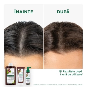 Balsam chinina si floare de colt Bio, 200ml, Klorane - Img 3