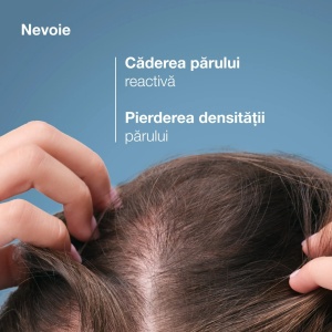 Sampon impotriva caderii cronice a parului Anaphase, 400 ml, Ducray - Img 3