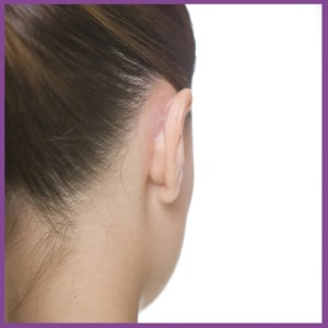 Corectoare pentru urechi decolate, clapauge, Otostick, 8 bucati - Img 5