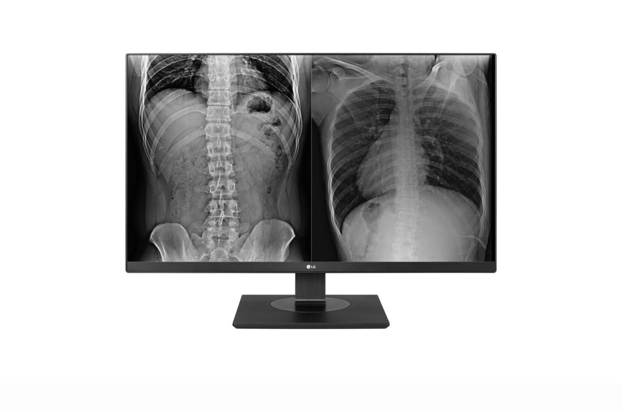 Monitor LG 27