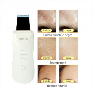 Aparat cu ultrasunete pentru curatare si exfoliere faciala, face lifting